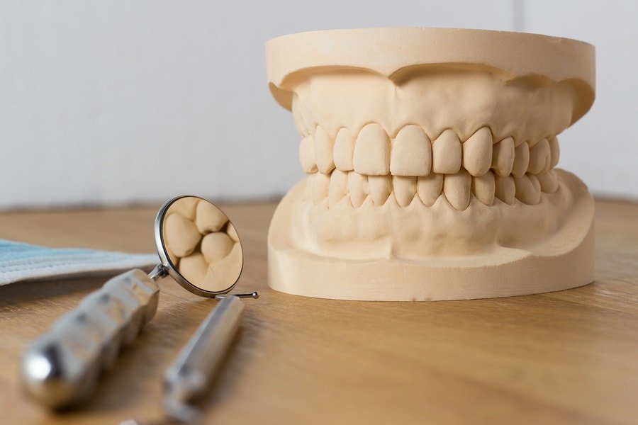 Dental Mold