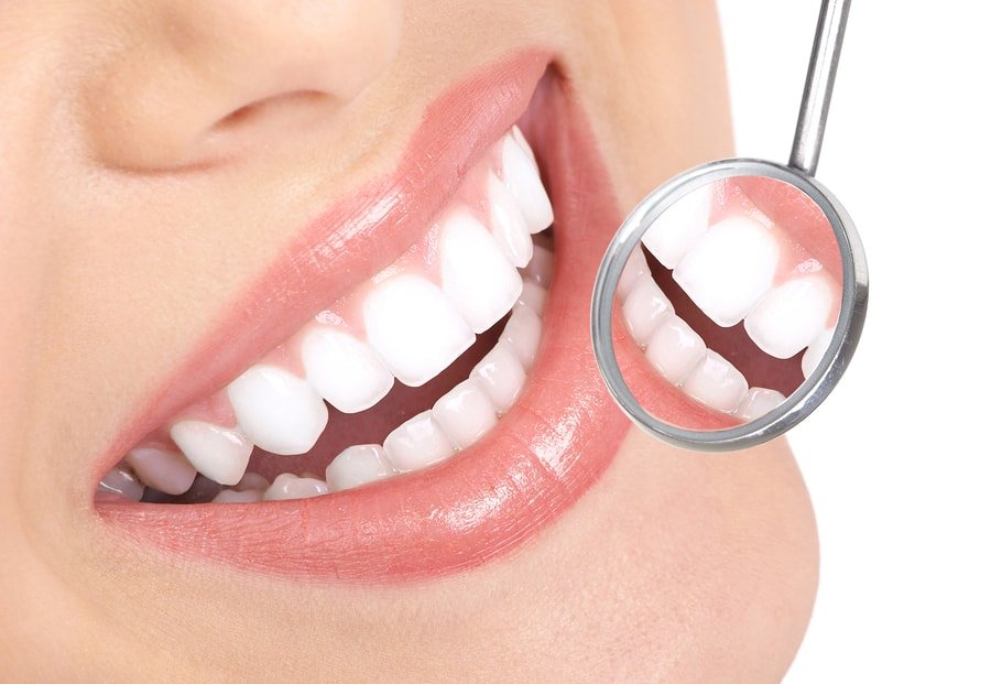 White Teeth